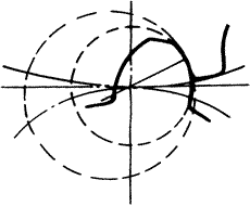 �X݆�����g(sh��)�Z(y��)�A���X݆�͈A���X݆��